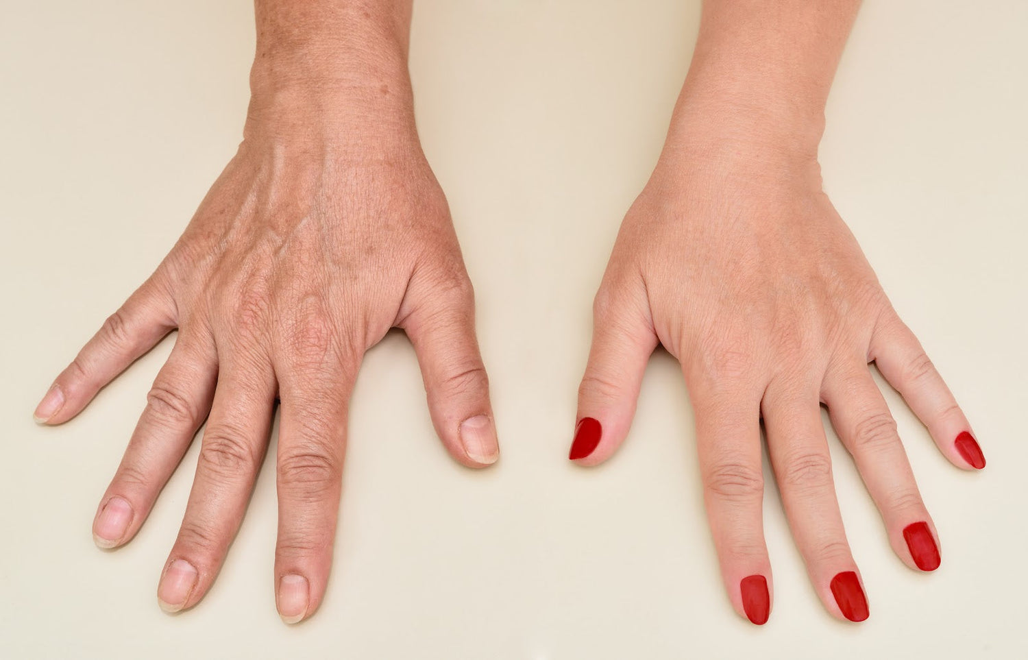 Red Light Therapy Solutions for Hand and Finger Wrinkles