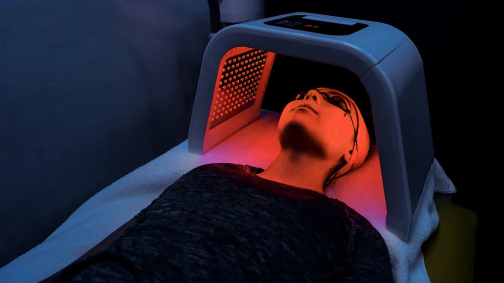 Red Light Therapy for Treating Hyperpigmentation