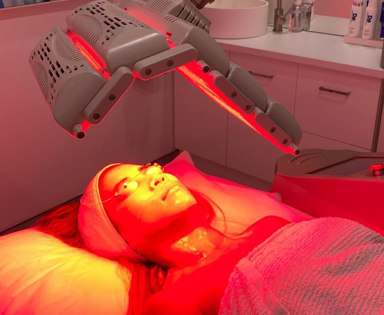 Red Light Therapy for Treating Laugh Lines