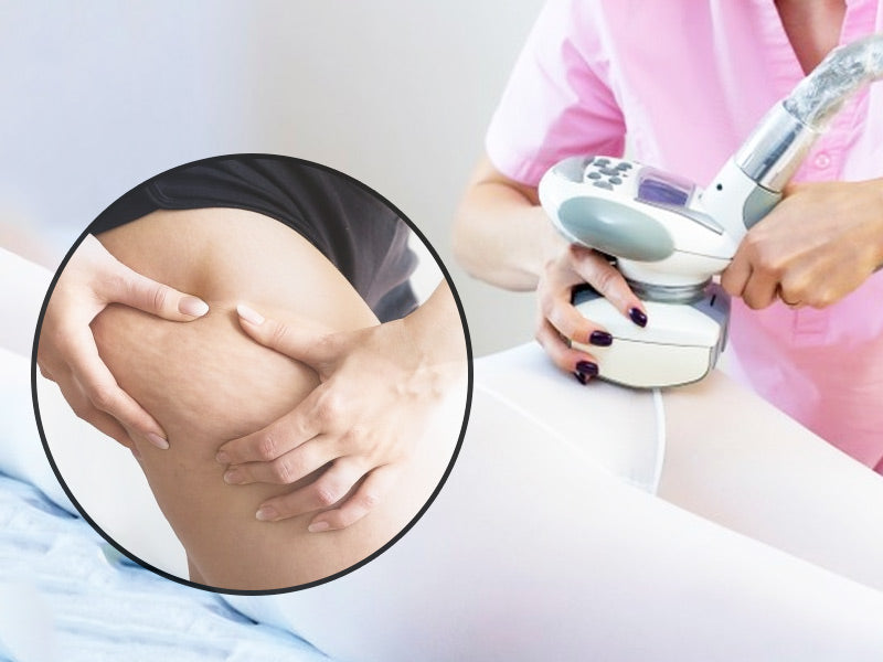 Maximising the Benefits of Ultrasound for At-Home Cellulite Reduction